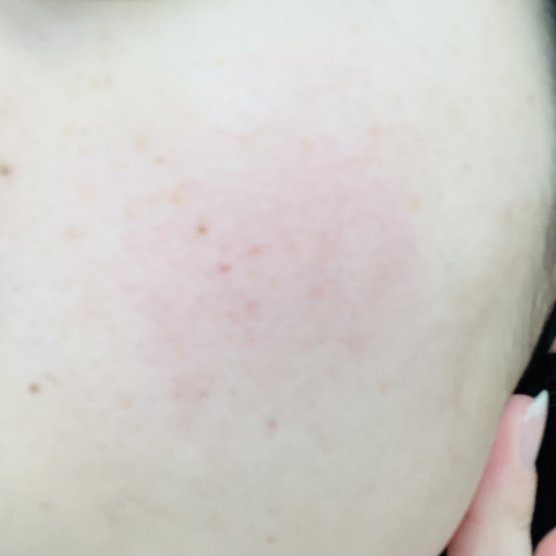 1番 ガルバニックパントテン酸スージングセラム/numbuzin/美容液を使ったクチコミ（3枚目）