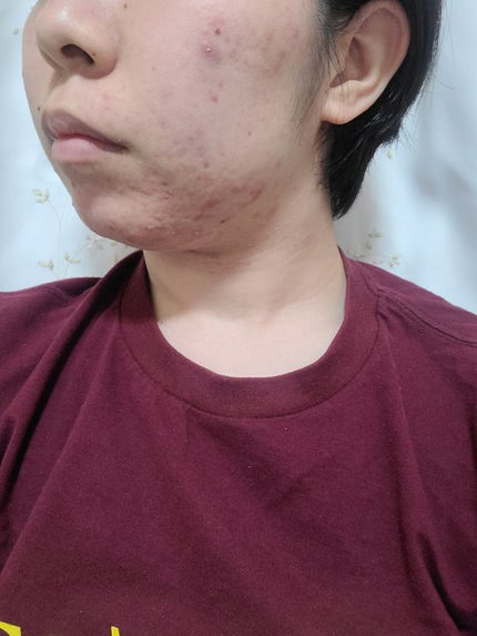 CICA スリーピングマスク/VT/シートマスク・パックを使ったクチコミ(3枚目)