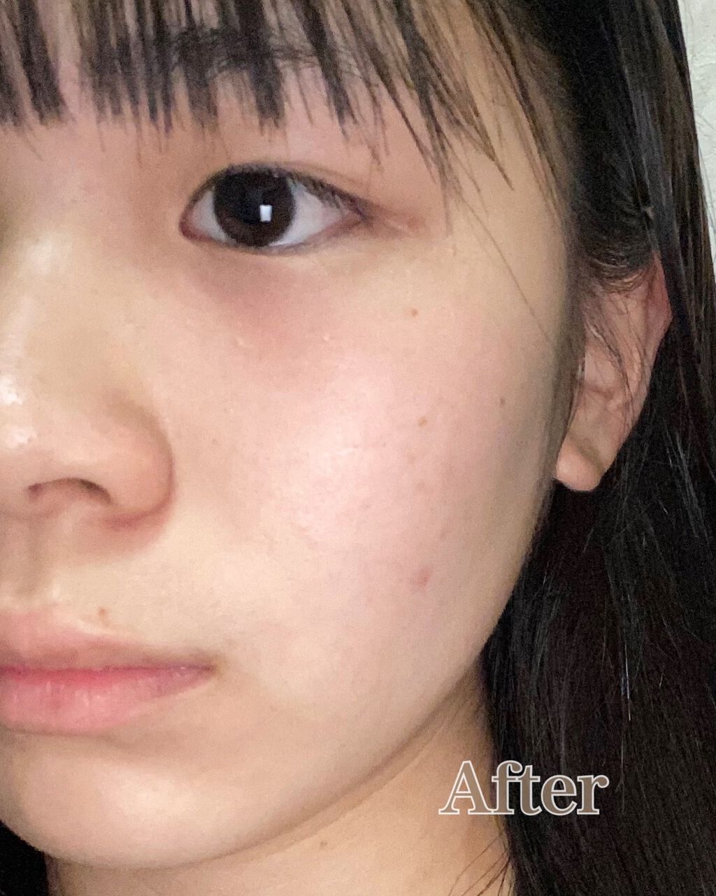 インビジブルピーリングブースターエッセンス/CNP Laboratory/ブースター・導入液を使ったクチコミ(3枚目)