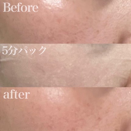 お米のマスク/毛穴撫子/シートマスク・パックを使ったクチコミ(5枚目)