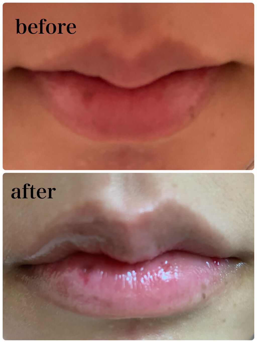 リップ バウンサー L-05/MARY QUANT/リップ美容液を使ったクチコミ（2枚目）