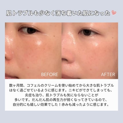 CUREPAIR MELA CREAM /KOPHER/フェイスクリームを使ったクチコミ(5枚目)