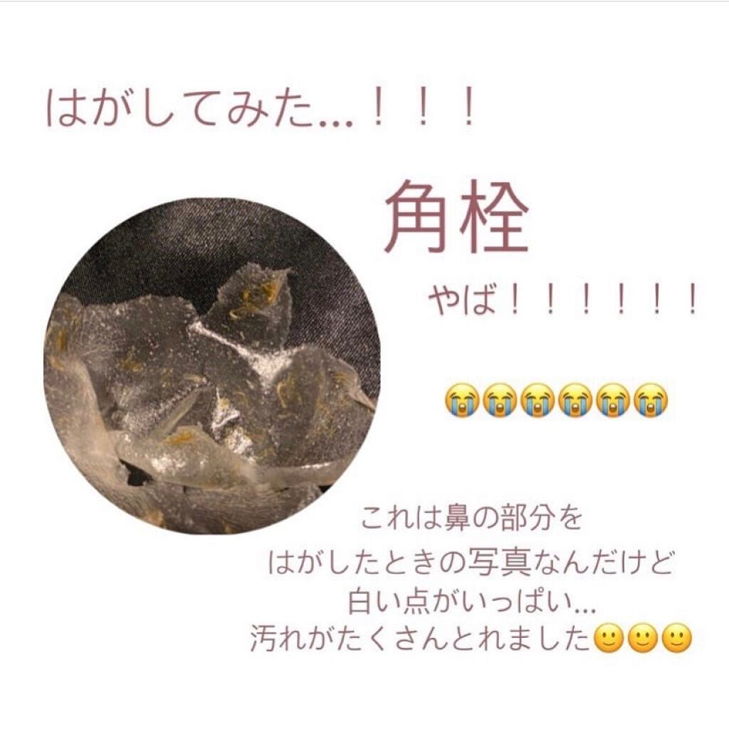 リアルカレンデュラピールオフパック/APRILSKIN/ピーリングを使ったクチコミ(5枚目)