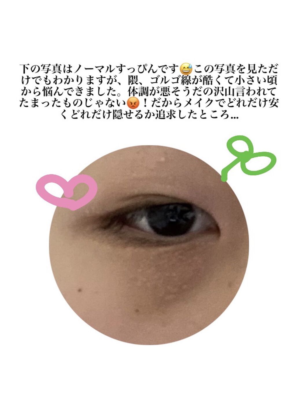 カラーミキシングコンシーラー 02 ナチュラルベージュ/キャンメイク/パレットコンシーラーを使ったクチコミ（2枚目）