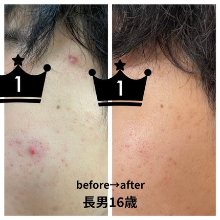 明色美顔水 薬用化粧水/美顔/化粧水を使ったクチコミ(2枚目)