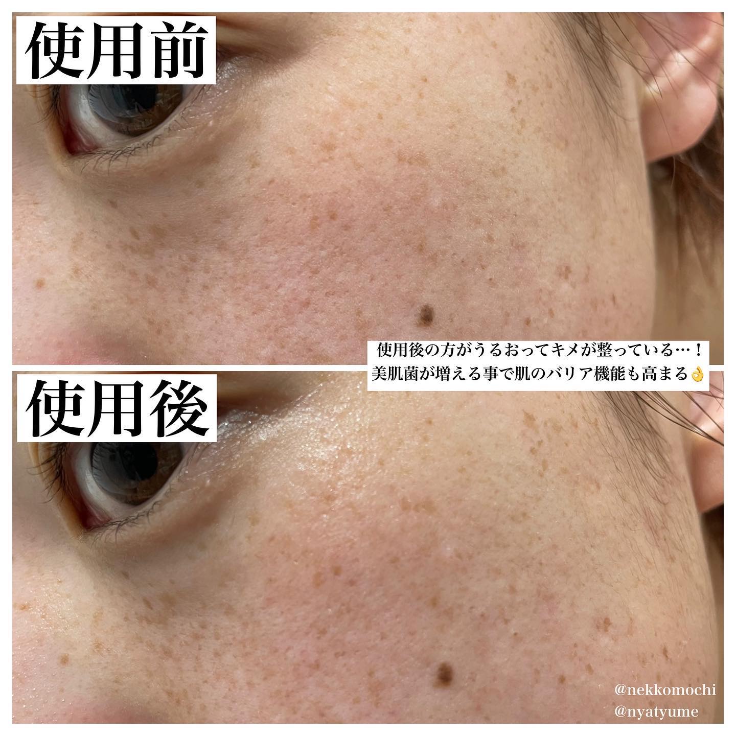 薬用 濃密美容液/d プログラム/美容液を使ったクチコミ（1枚目）