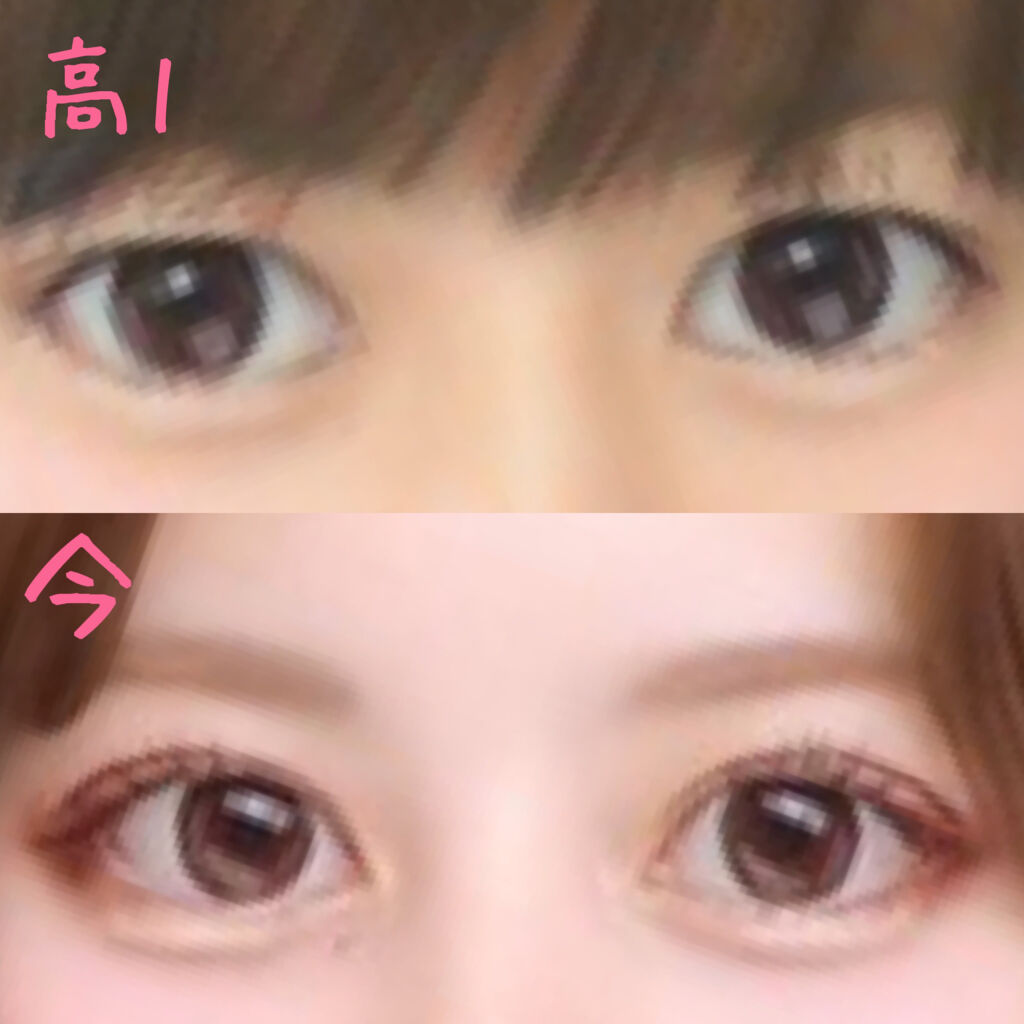 オリシキ アイリッドスキンフィルム		/D-UP/二重まぶた用アイテムを使ったクチコミ（3枚目）