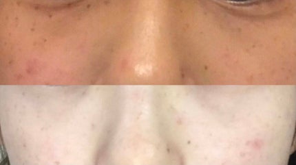 ハイドロクリームPHQ-8/KISO/美容液を使ったクチコミ(4枚目)