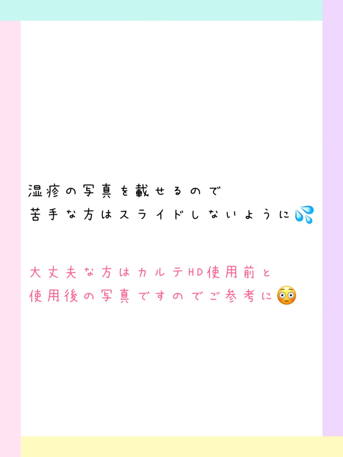 モイスチュア ローション/カルテHD/化粧水を使ったクチコミ（1枚目）