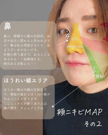 おゆみ|ニキビ・ニキビ跡ケア on LIPS 「【頬ニキビ原因MAP〜最も潰されてしまいがちなニキビ達〜】こん..」（4枚目）