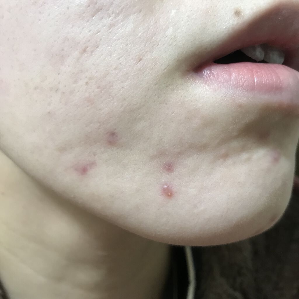 クリームバー ファンデーションN/ナチュラグラッセ/その他ファンデーションを使ったクチコミ（3枚目）