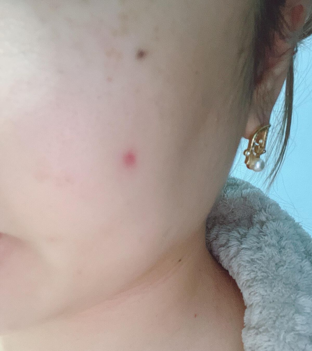 マジックティーツリーオイル/ブラン/フェイスオイルを使ったクチコミ(1枚目)