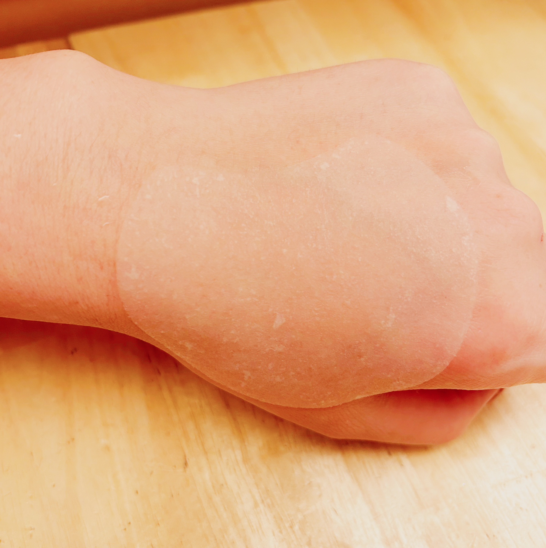 センテラ クイックカーミングパッド/SKIN1004/トナーパッドを使ったクチコミ（3枚目）