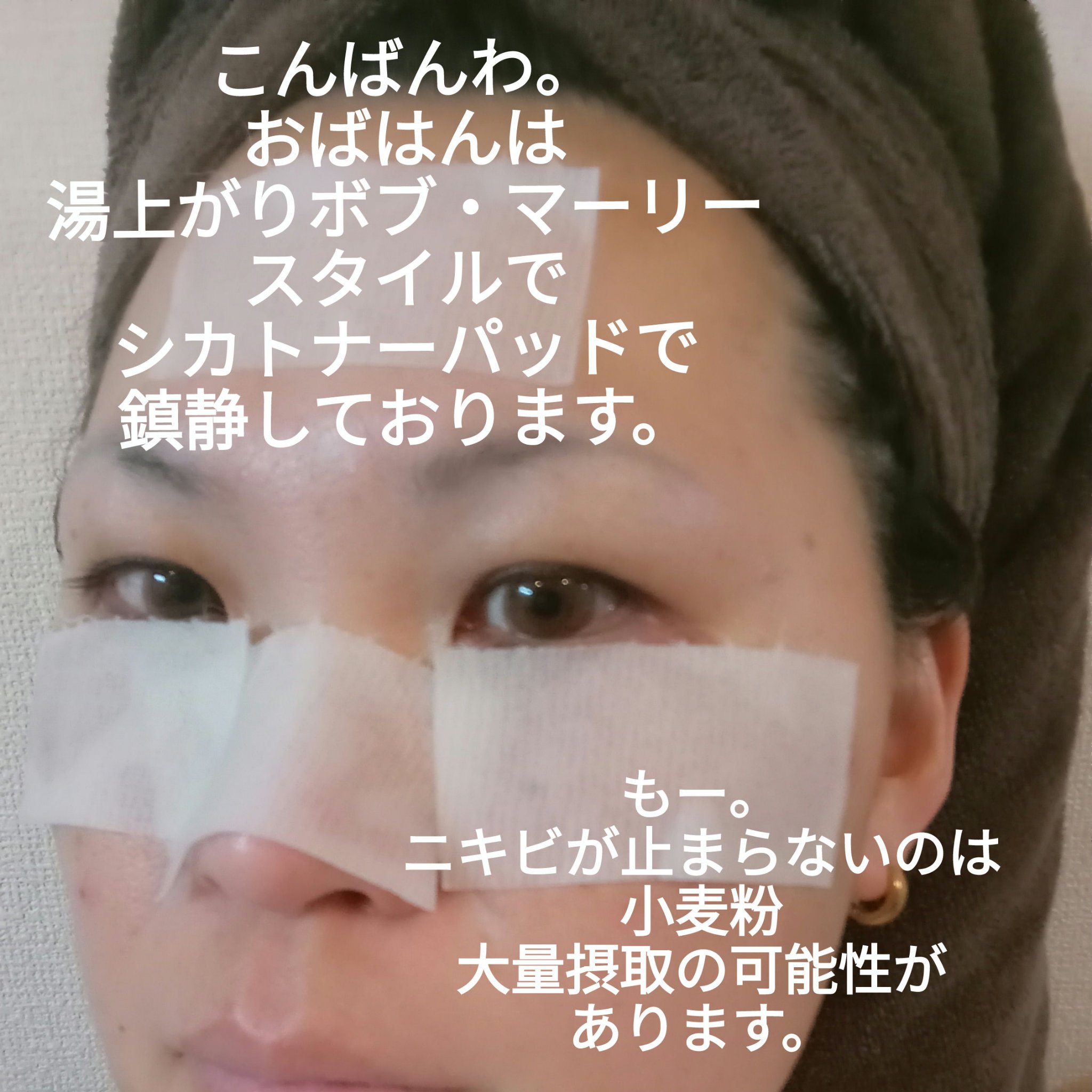 シカピーリングトナーパッド/ONE THING/トナーパッドを使ったクチコミ（1枚目）