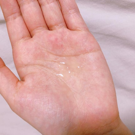 ニキビあとケアジェル/アットノン/その他スキンケアを使ったクチコミ(3枚目)