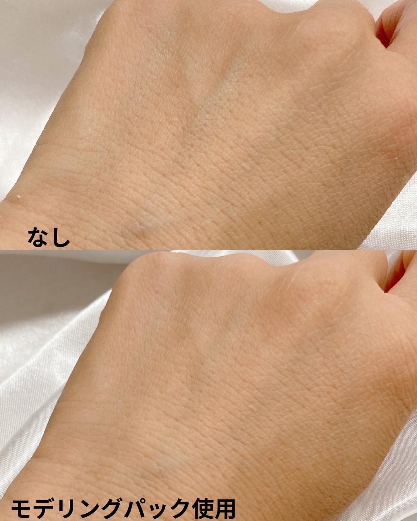 ドクダミ化粧水/ONE THING/化粧水を使ったクチコミ(10枚目)