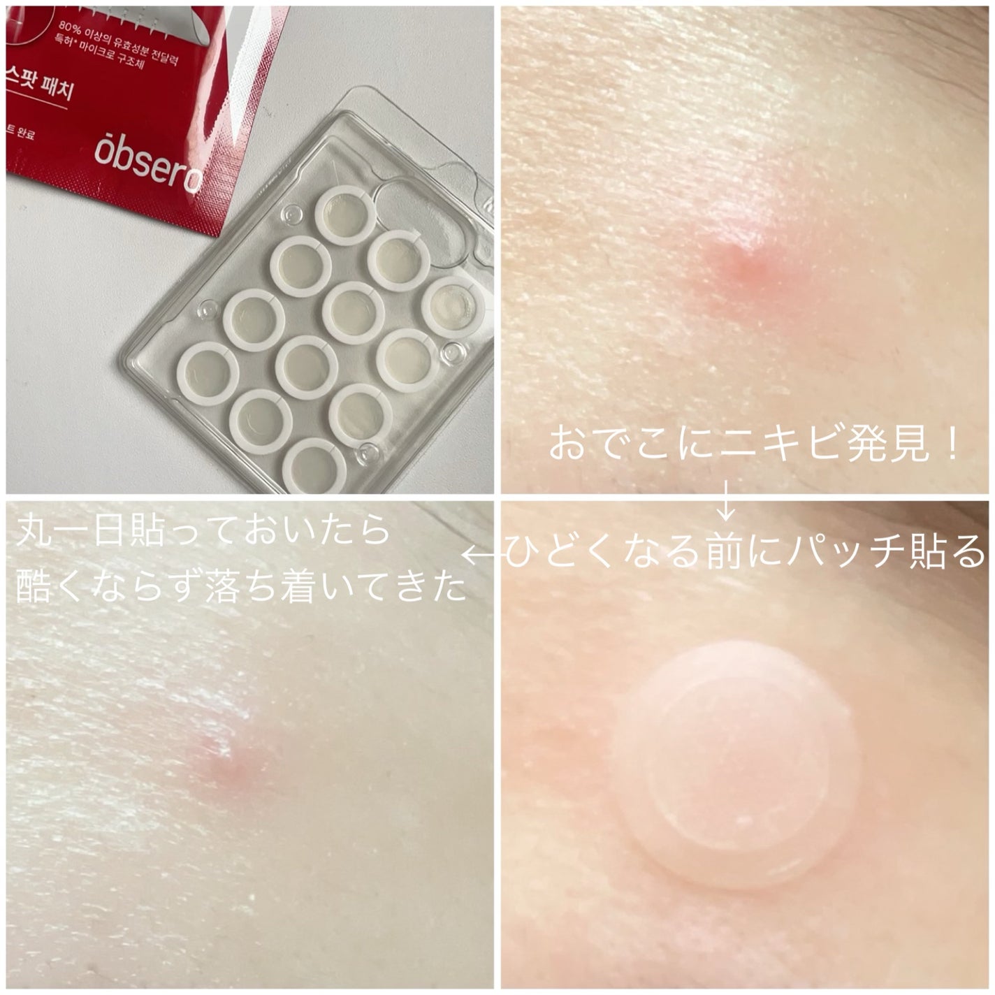 グリーンカーミングブルーレーションクリーンアンプル/obsero/美容液を使ったクチコミ(5枚目)