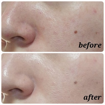 ワンナイトクッション/Nakeup Face/クッションファンデーションを使ったクチコミ(3枚目)