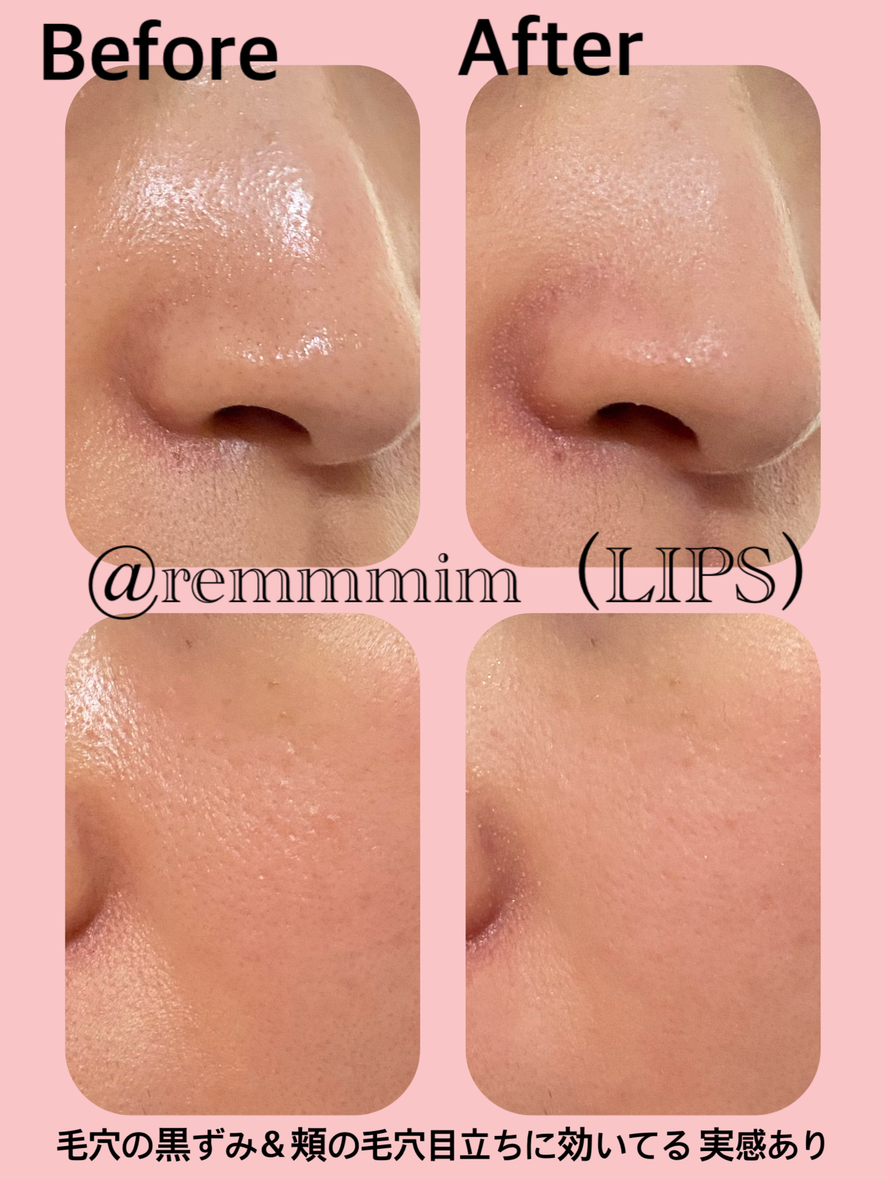 アフロディアナ炭酸パック 【公式通販】