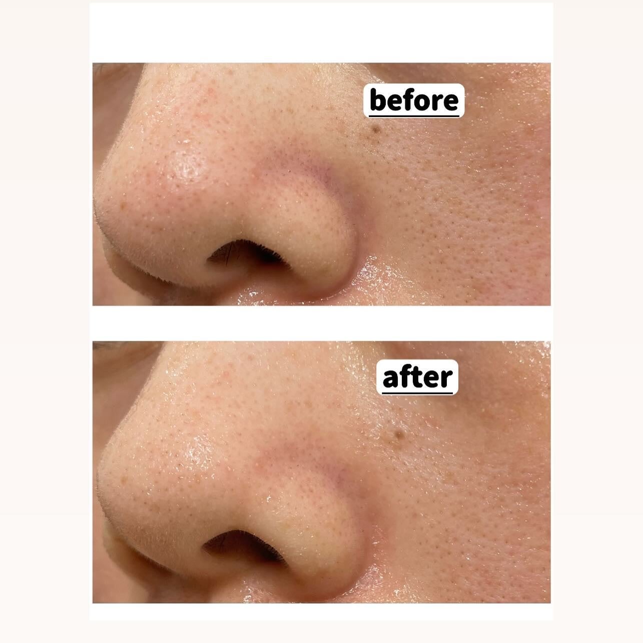 カロテン IPMP カーミング & ハイドレーティング シートマスク/APRILSKIN/シートマスク・パックを使ったクチコミ(4枚目)