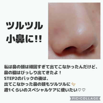 ナチュラルマイルドクリアノーズパック/ilso/シートマスク・パックを使ったクチコミ(7枚目)