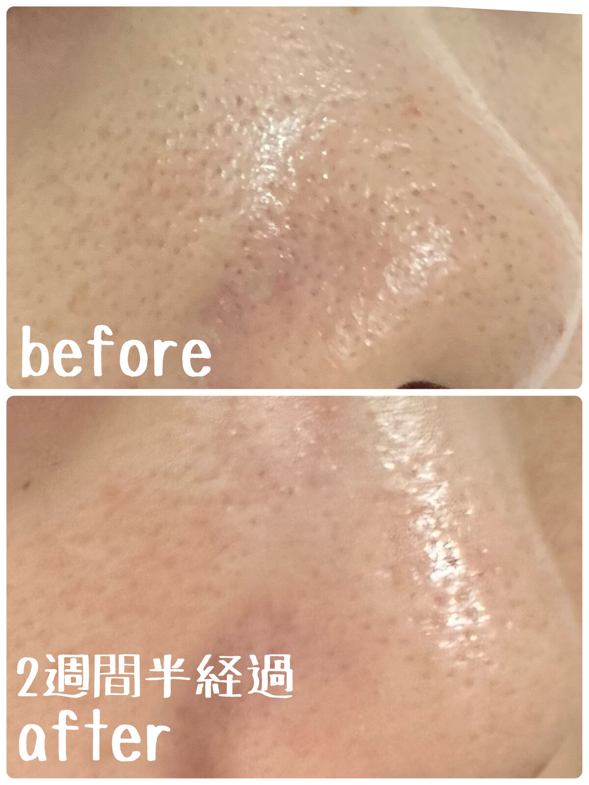 薬用 雪肌精/雪肌精/化粧水を使ったクチコミ（1枚目）