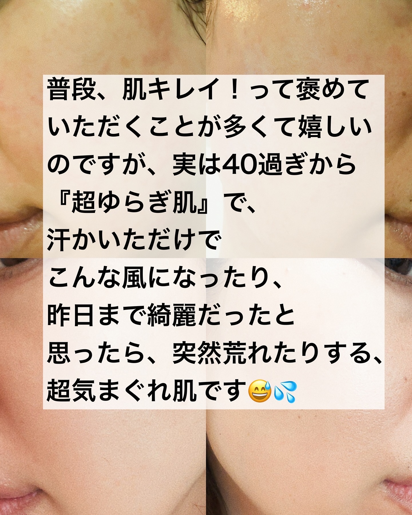 ノスカナイン トラブル セラム/FATION/美容液を使ったクチコミ（2枚目）