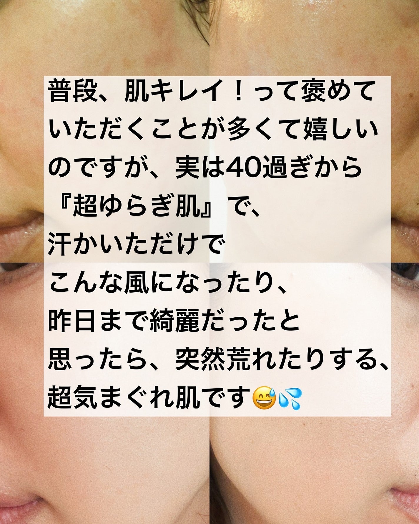 ノスカナイン トラブル セラム/FATION/美容液を使ったクチコミ(2枚目)