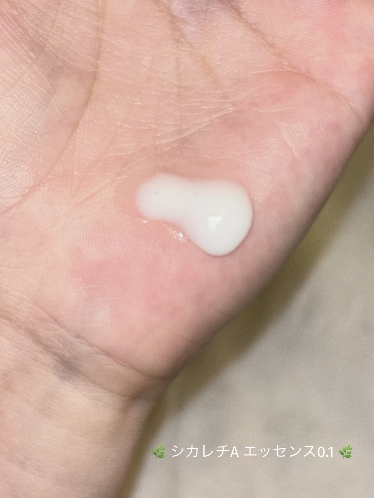 シカレチA エッセンス0.1/VT/美容液を使ったクチコミ（3枚目）