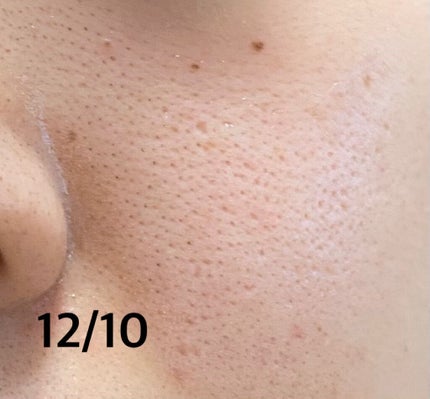 リンクルエッセンスローション(超しっとり)/モイスタージュ/化粧水を使ったクチコミ(3枚目)