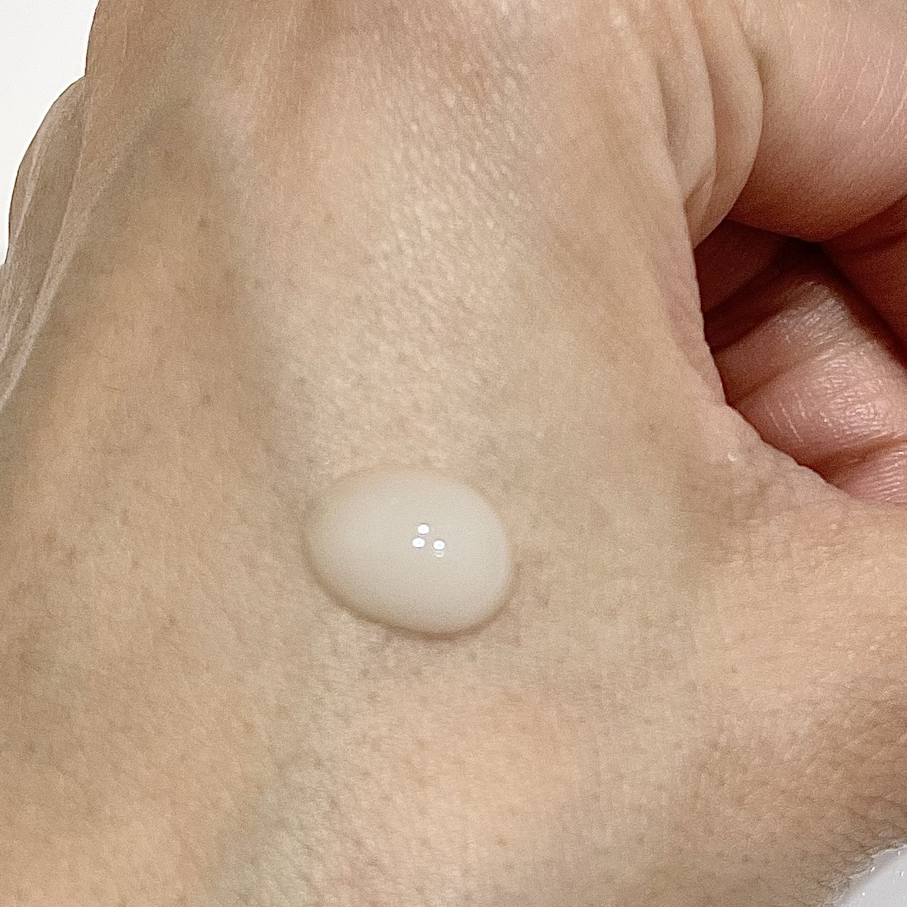 ビディ ニードルエッセンス NN/ビディ/美容液を使ったクチコミ（2枚目）