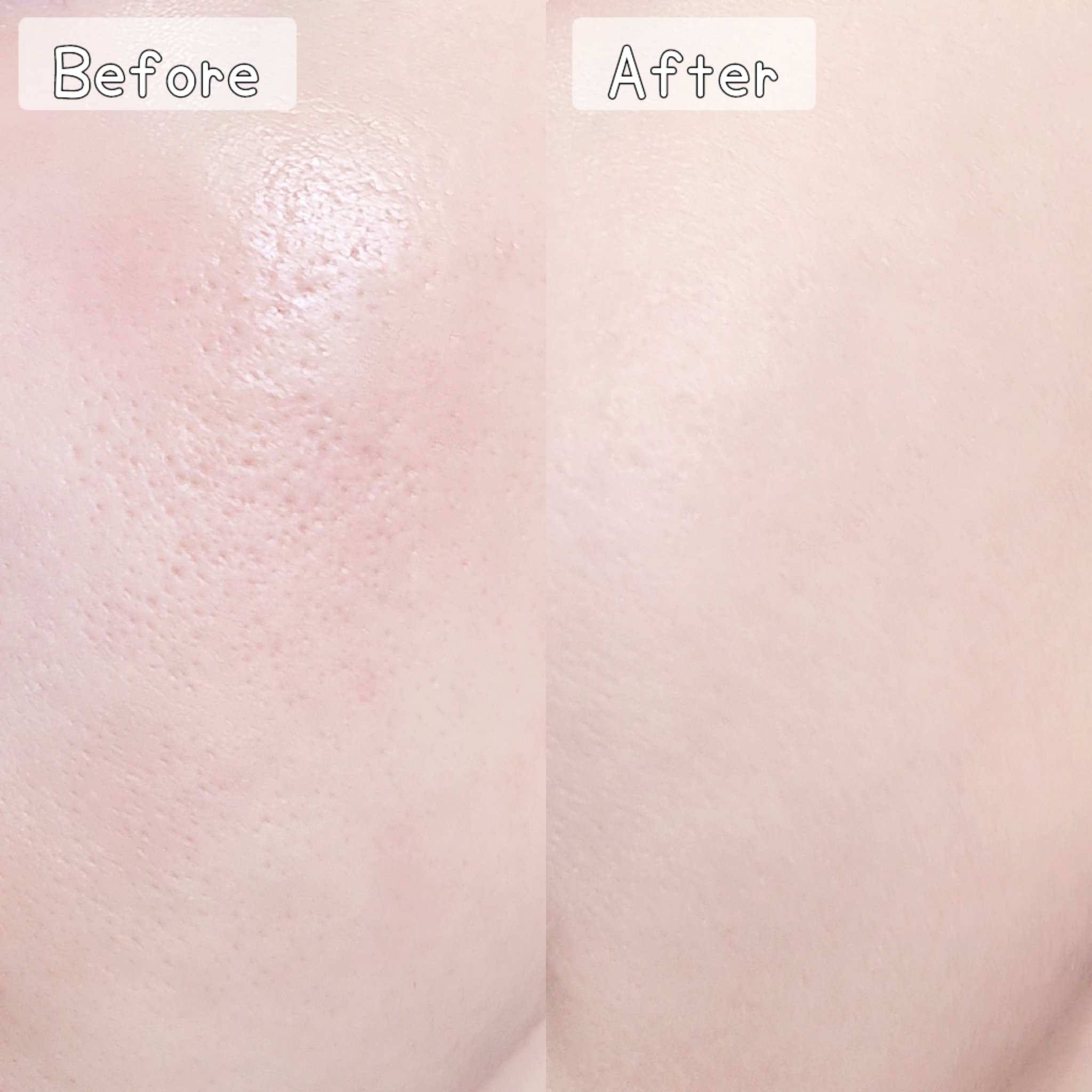 ピンクティーツリーカバークッション/APLIN/クッションファンデーションを使ったクチコミ（3枚目）