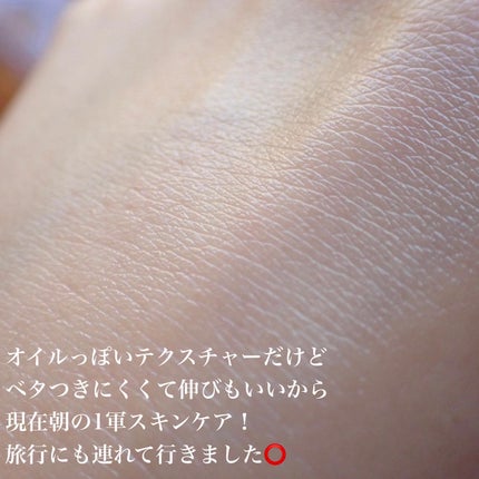 naðãã©ããŒè¿ãðââïž on LIPS ã.LIENJANG(@lienjang_cosme.jp)ãªãš..ãïŒ5æç®ïŒ