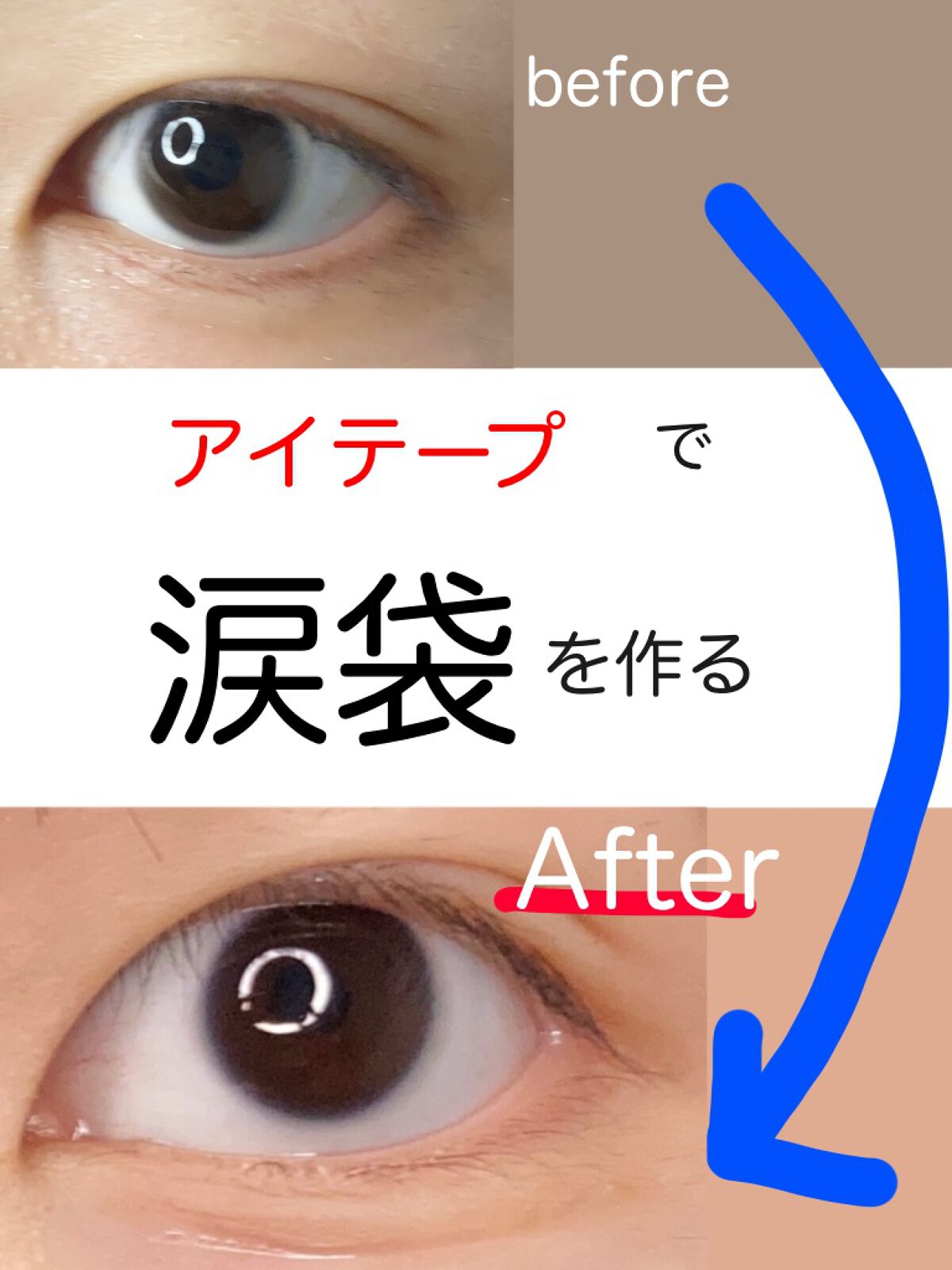 ふたえファイバーテープ 両面ストロング 1 8mm幅 Daisoの口コミ 超優秀 100均で買えるおすすめ二重まぶた用アイテム アイテープで涙袋をつくる By ののの フォロバ100 投稿有りの方 混合肌 10代後半 Lips