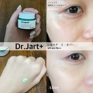 シミ、クマ、赤みを隠しながらスキンケアの延長感覚で🌿♡神コスパの最強下地👨🏻‍⚕️❗️

Dr.Jart＋ ドクタージャルト シカペア リカバー

ニキビや吹き出物、肌の調子が良くない日や
お休みであま