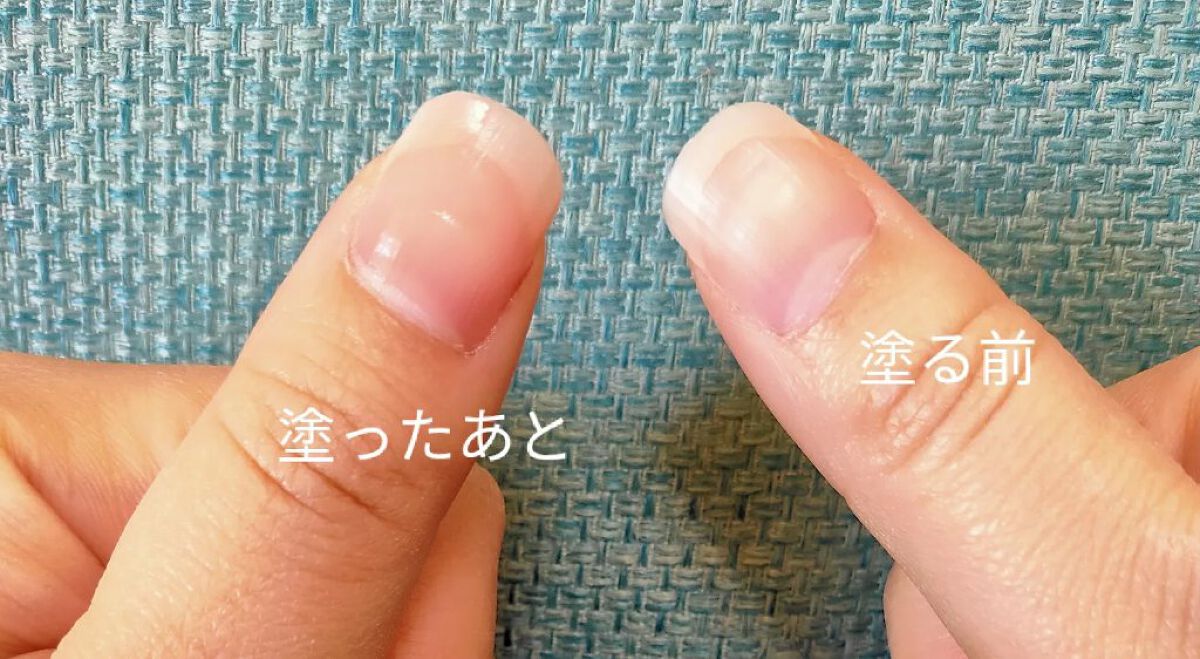 1Day密封ネイルケアパック/DAILY NAILLY/ネイルオイル・トリートメントを使ったクチコミ(8枚目)