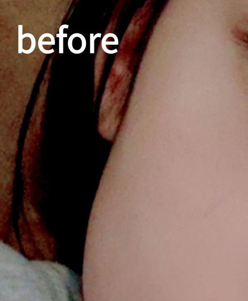 yuika_은어♡ on LIPS 「皆さん!ハトムギ化粧水とNIVEAパックを1週間したら、こんな..」(2枚目)