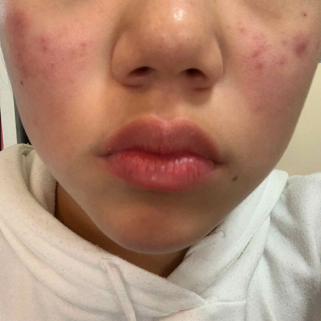 sihiho☆ on LIPS 「初投稿です初めまして、sihihoです!!誰か、助けてください..」(1枚目)