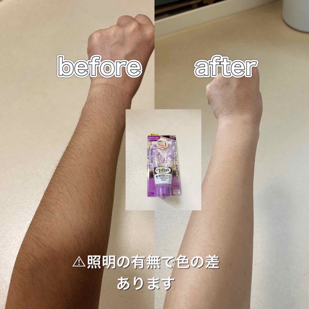 除毛クリームキット敏感肌用/エピラット/除毛クリームを使ったクチコミ(3枚目)