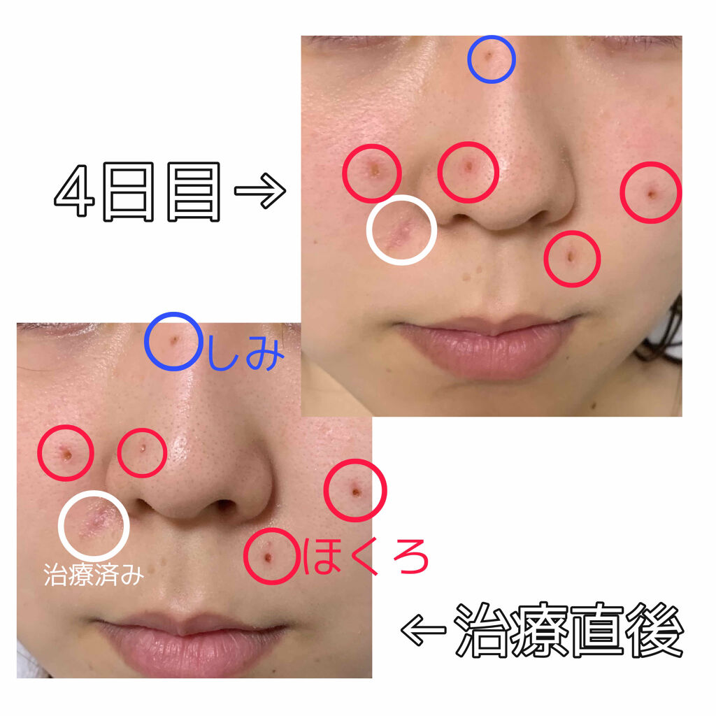 を使ったクチコミ（2枚目）