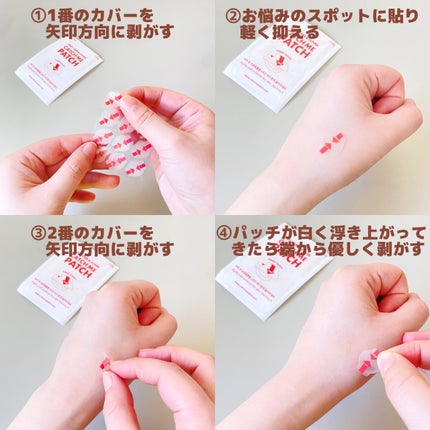 キャッチミーパッチ/CATCH ME PATCH/にきびパッチを使ったクチコミ(5枚目)