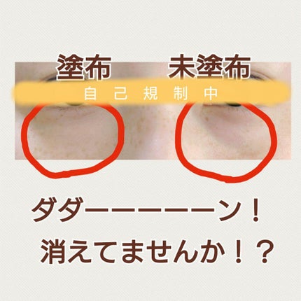 サイレントカバー コンシーラー/excel/パレットコンシーラーを使ったクチコミ(3枚目)