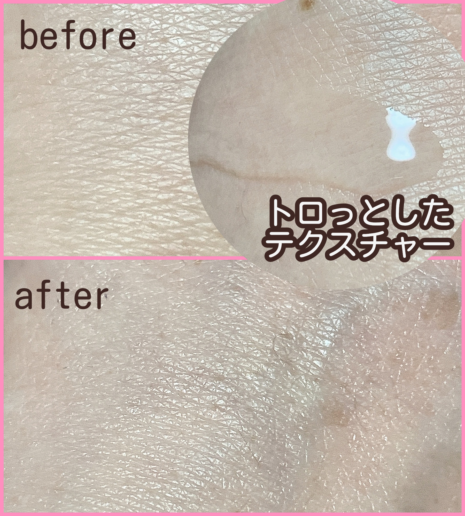 クローザーセラム/Frankly/美容液を使ったクチコミ（2枚目）