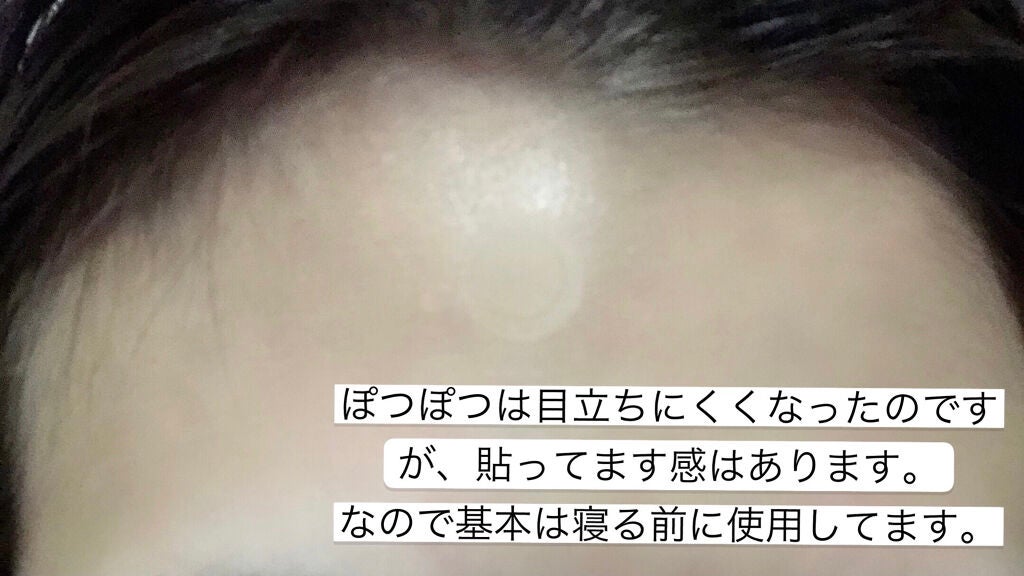 ゼロスポットパッチ/Today’s Cosme/にきびパッチを使ったクチコミ(4枚目)