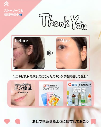 なぎ | スキンケア薬剤師 on LIPS 「◀︎ニキビ肌から毛穴レスになった薬剤師洗顔はさっぱり派の人!🙋..」(8枚目)