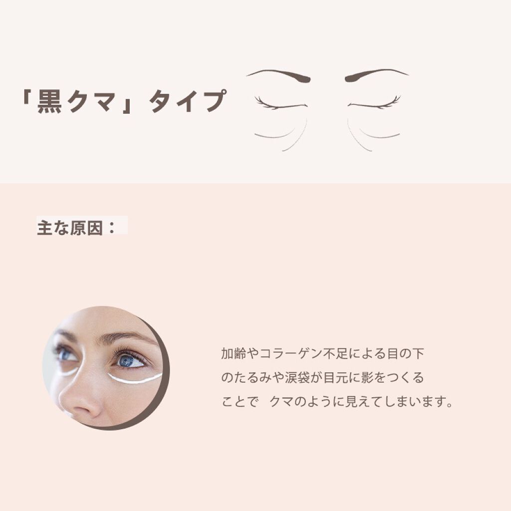L&L Skin on LIPS 「アナタのクマはこんなタイプ?👀📢「黒クマ」主な原因:加齢やコラ..」(2枚目)