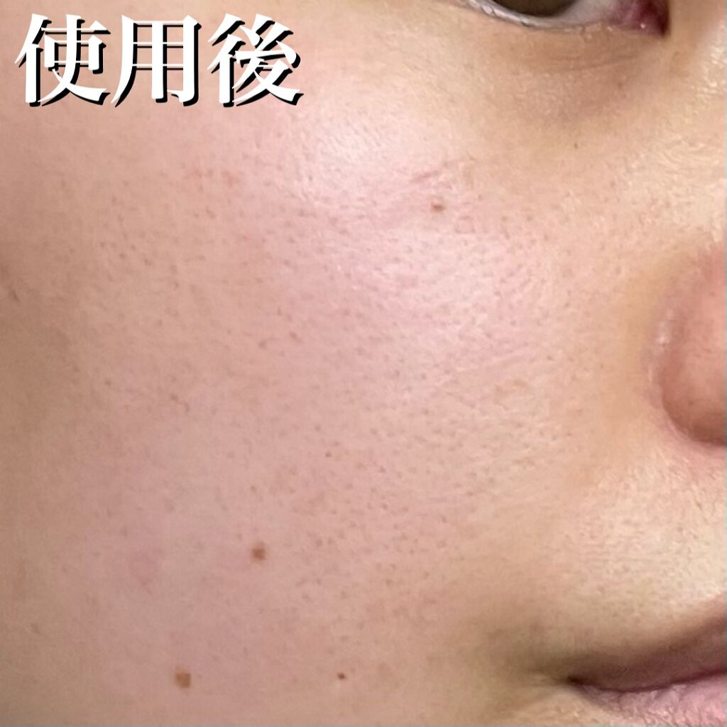 フルフィットプロポリスシナジートナー/COSRX/化粧水を使ったクチコミ(8枚目)