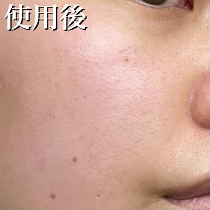 フルフィットプロポリスシナジートナー/COSRX/化粧水を使ったクチコミ(8枚目)