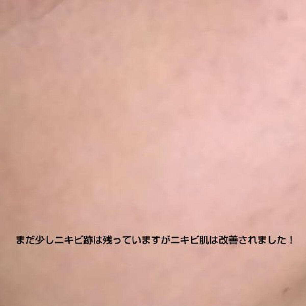 チョコラBBドリンクビット（医薬品）/チョコラBB/その他を使ったクチコミ（3枚目）