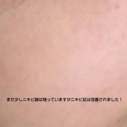 チョコラBBドリンクビット(医薬品)/チョコラBB/その他を使ったクチコミ(3枚目)